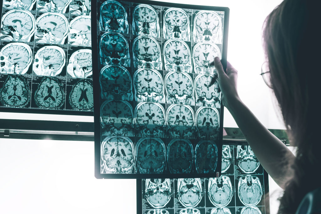 O perfil de uma mulher com uma mulher segurando um raio-x de múltiplas varreduras cerebrais