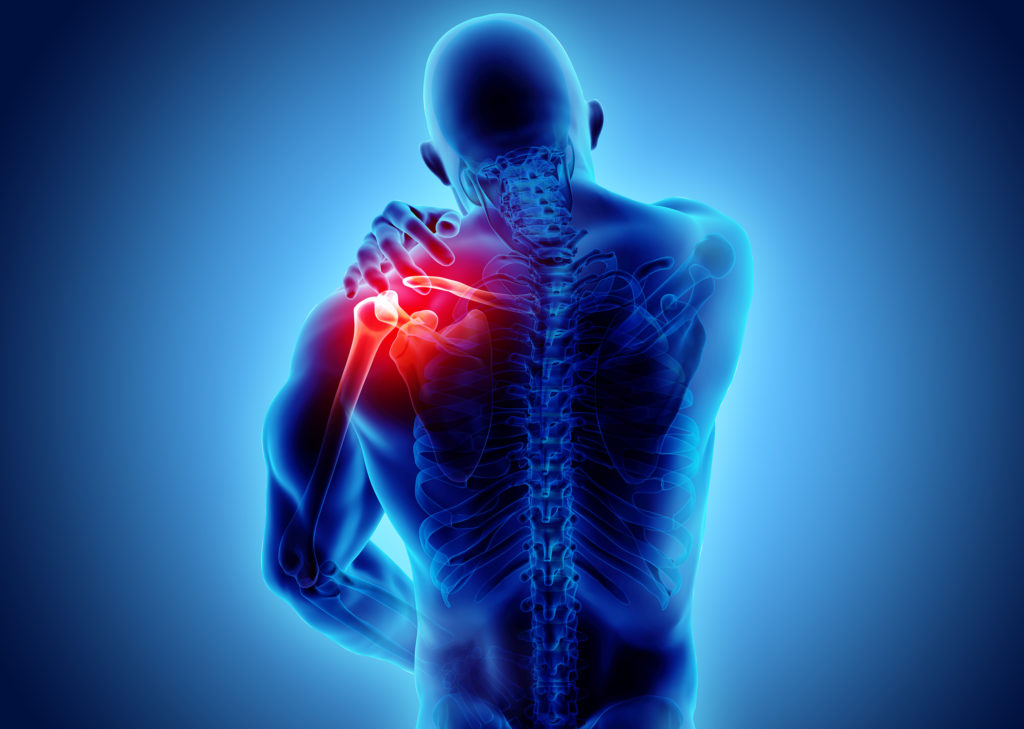 Uma imagem de raio-x azul de um homem segurando seu ombro vermelho dolorido com dor