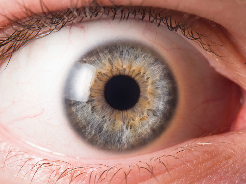 Um close-up de um olho azul com manchas marrons claras ao redor da íris